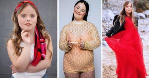 An Inspiring Story of a Welsh woman with Down's syndrome signed by a top modeling agency