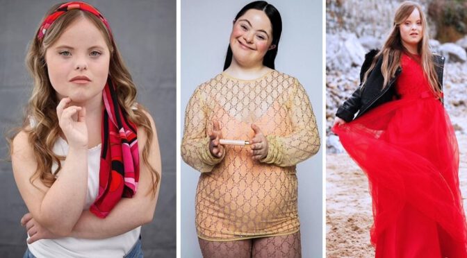 An Inspiring Story of a Welsh woman with Down’s syndrome signed by a top modeling agency