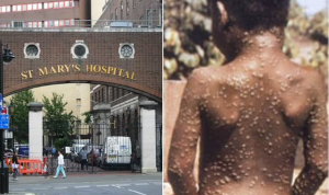 Two more cases of monkeypox infection have been reported in England